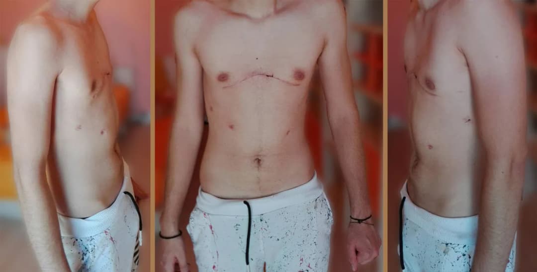 Pectus co znaczy po polsku? Łacińskie słowo w anatomii